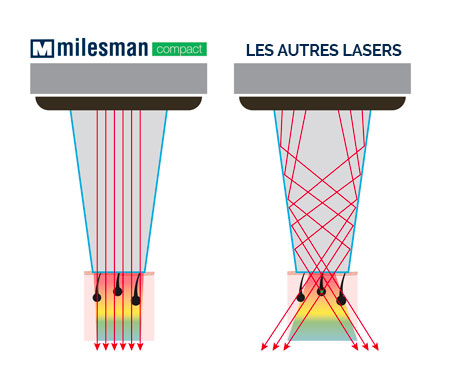 laser_milesman